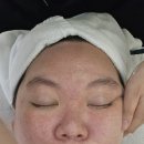 제네틱 | 수원 피부관리 유에스파 영통 에스테틱 제네틱 케어 후기