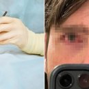 만성안경 이미지