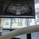 홍익치과의원 | 그게 너의 사랑이라면 차라리 나를 쏴버려줄래