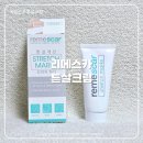 스마티언 | [임산부 튼살크림] 국내유일 식약처 허가 받은 '리메스카 튼살크림' 솔직 사용 후기