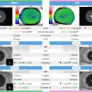 e.편한안경 이미지