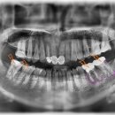서울산성플란트치과의원 이미지