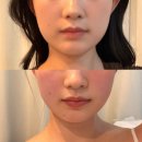 민스킨케어 | 성북구 피부샵] 경락관리 예비 신부 관리 추천 '민스킨앤바디' 작은 얼굴 웨딩케어 솔직후기 (비포/애프터)