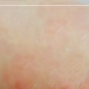 대구프리허그한의원 이미지