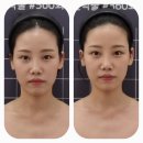 고아라 | 전주 윤곽관리 끝판왕✨ 손끝으로 얼굴을 조각하는 고아라 컨투어샵 내돈내산 리얼후기