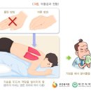 기관지 확장증 치료와 관리 이미지