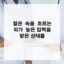 센텀속시원내과의원 | 혈관 속을 흐르는 피가 높은 압력을 받은 상태를