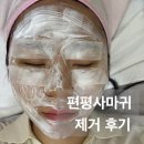 미앤지의원 | 편평사마귀 레이저제거 후기 ( 듀오덤 없이 회복한 과정 + 사용 연고 )