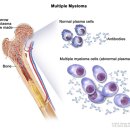 메디포레스트 필라테스 이미지