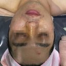 라벨테라피 이미지