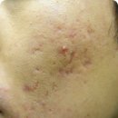 휴본한의원 이미지