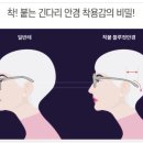 키다리안경 이미지