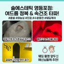 솔케어 | [영등포피부관리] 스튜디오 촬영 앞두고 솔에스테틱 영등포점에서 여드름 케어 받은 솔직 후기