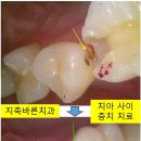 상주치과기공소 이미지