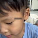 이노플러스성형외과의원 | 하하하… 내가 여길 또 가게 되다니｜65개월 형아 찢어짐 봉합 후기 전주 이노플러스성형외과