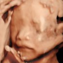 바우약국 - 광명시 광명로831번길 15 | [임신일기 : 21주차] 정밀초음파 후기 | 한마음병원 산부인과