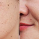 포이즌의원 이미지