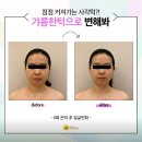 근육학아카데미학원 | 얼굴형 리프팅, 위뷰티에서 발사지로 원하는 얼굴형 완성