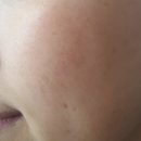 P-5409 | 임산부화장품 럽피 바디버든줄이기