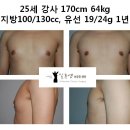 25세 강사 170cm 64kg 지방100/130cc, 유선 19/24g 1년 이미지