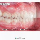 더스마일치과의원 네이버블로그