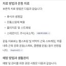 거위발건염 때 스쿼트 해도 되네요? 이미지