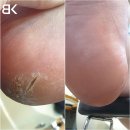 BK민방경네일