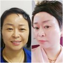 단아인셀덤