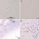 흰다리새우 간췌장 미포자충 Ecytonucleospora hepatopenaei (EHP)의 신속 현미경적 진단법 이미지
