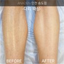 아나덴 슈가링왁싱 인천송도점 이미지