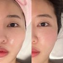 뷰티라인업 | Skin : 강변역 에스테틱 '뷰티라인업' 웨딩케어 관리 후기