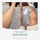 행복을다리는집 | [평택 왁싱] 털업왁싱 평택비전점 다리 왁싱으로 매끈해진 후기