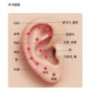 귀로 보는 건강클리닉 이혈 | WBL 이혈테라피 주얼패치 체험 후기(식욕조절 + 생리통 완화)
