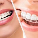 다산센트럴치과교정과치과의원 | 다산교정치과, 교정 언제 시작하는게 좋을까?