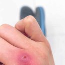 에이치봄의원 이미지