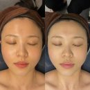 아마릴리스뷰티 | 서울 강서구ㅣ마곡 피부관리 추천 아마릴리스뷰티ㅣ수기 윤곽관리 솔직후기