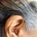 오티콘보청기 고양덕양점 이미지