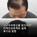 MZ가 원하는 것은 무엇인가 - Identity | 대구두피문신을 받으려면? 리게인프로젝트 실제 후기와 방문 정보 완벽 공유