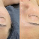 i 피부샵 이미지