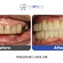 수플러스치과기공소 이미지