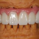 하늘치과기공소 이미지