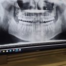 웰컴치과의원 | 국가건강검진 성인구강검진, 남포동 구강검진, 남포동웰컴치과 후기!!!