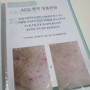 잠실 피부관리, 꼼꼼케어의 끝판왕 “가희하다”