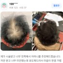 미모헤어라인
