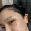 연세보드미의원 네이버블로그
