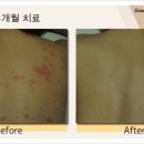 수원해소한의원 이미지