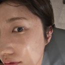 뷰티의신 - 중구 | 마천역 피부관리 잘하는곳 뷰티의신 초음파 리프팅 관리 후기