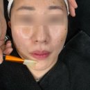 용문사우나 | [대전 용문동] 최초 도입 합법 레이저 피부 관리 &#34;설브 꼼에스테틱 대전 용문점&#34;