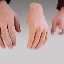 바른의수족제작연구소 이미지