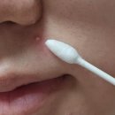 에이씨솔루션 | 스팟 고민엔 닥터슈라클 에이씨 큐어 솔루션 블루원, 그린투